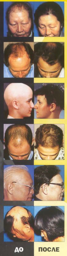 izkis152.jpg izkis152.jpg